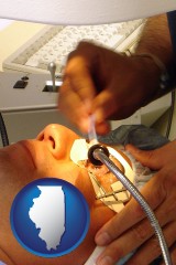 illinois map icon and lasik laser eye surgery for vision correction