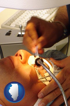 lasik laser eye surgery for vision correction - with Illinois icon