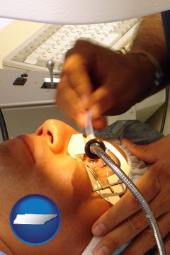 lasik laser eye surgery for vision correction - with Tennessee icon