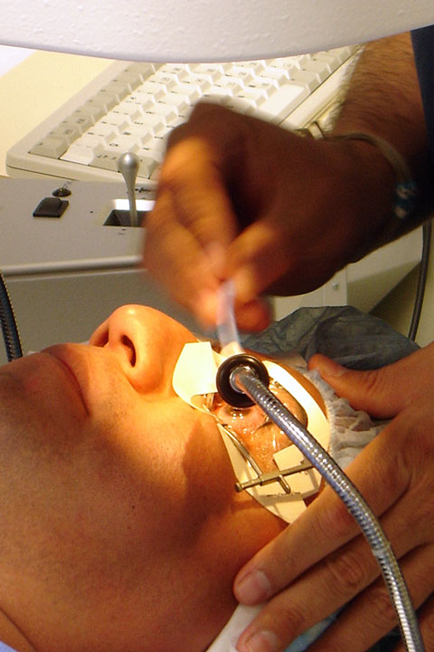 lasik laser eye surgery for vision correction